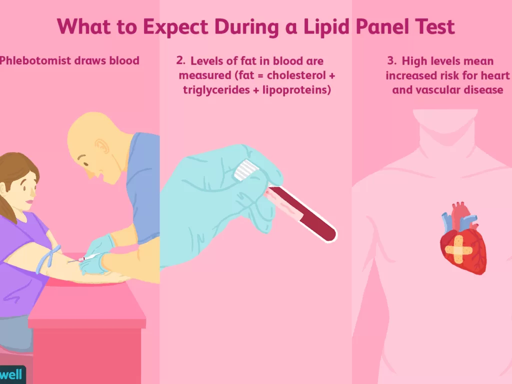 LIPID PROFILE Monitoring Your Cholesterol levels 29